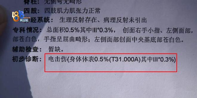 厥筋都断了……街上常见看见立即远离j9九游会登录后怕！5岁男童瞬间晕(图2)